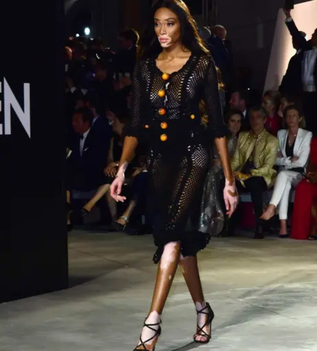 Image 1735108 from Winnie Harlow