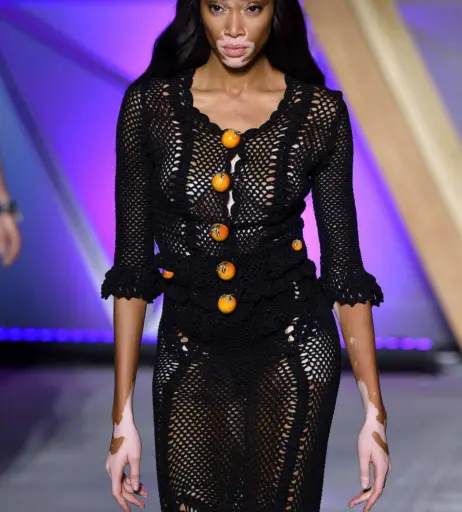 Image 1735136 from Winnie Harlow