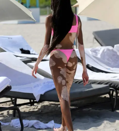 Image 1736833 from Winnie Harlow