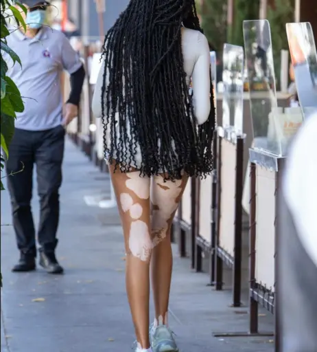 Image 1736508 from Winnie Harlow