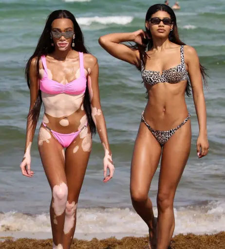 Image 1736908 from Winnie Harlow