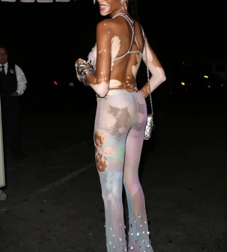 Image 1734813 from Winnie Harlow