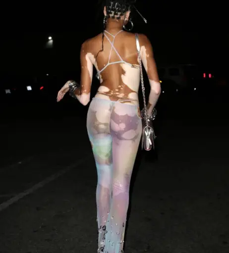 Image 1734828 from Winnie Harlow