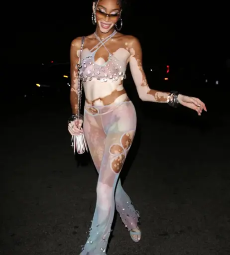 Image 1734596 from Winnie Harlow