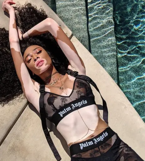 Image 1734168 from Winnie Harlow