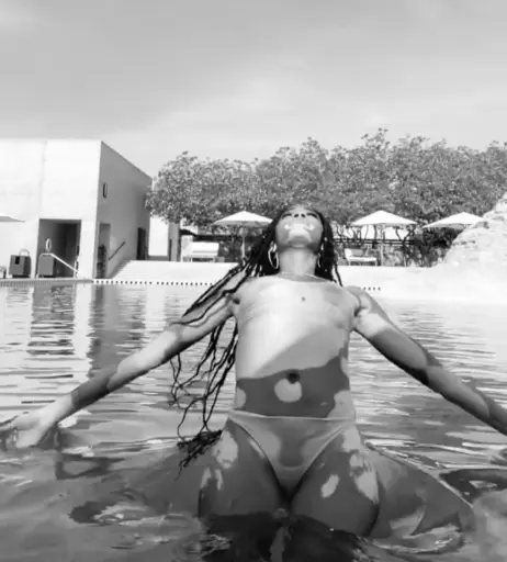 Image 1734104 from Winnie Harlow
