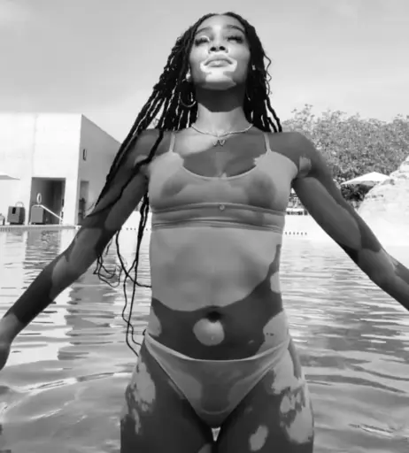 Image 1734080 from Winnie Harlow
