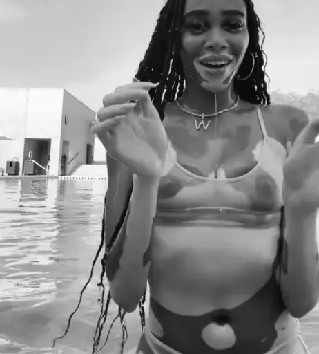 Image 1734048 from Winnie Harlow