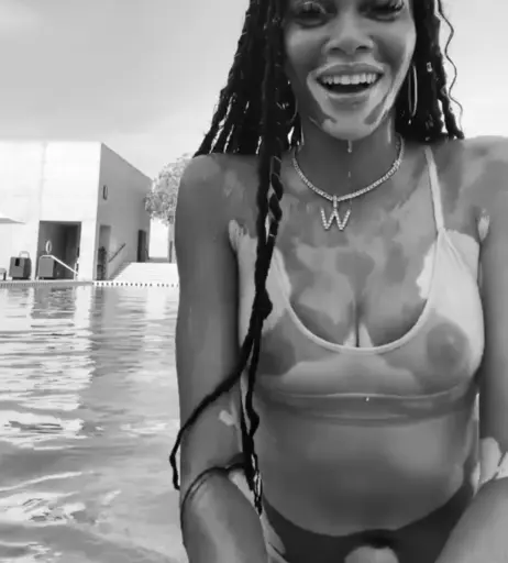 Image 1734033 from Winnie Harlow