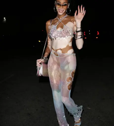 Image 1734962 from Winnie Harlow