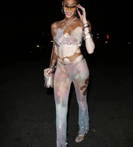 Image 1734931 from Winnie Harlow
