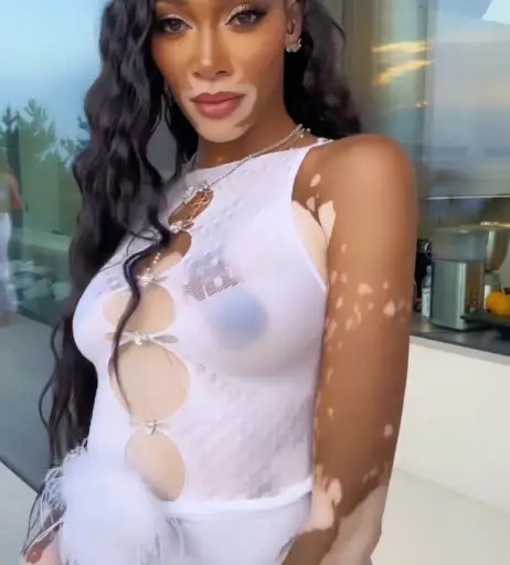 Image 1731856 from Winnie Harlow