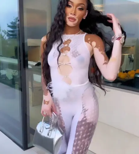 Image 1731843 from Winnie Harlow