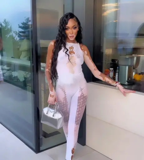 Image 1731819 from Winnie Harlow