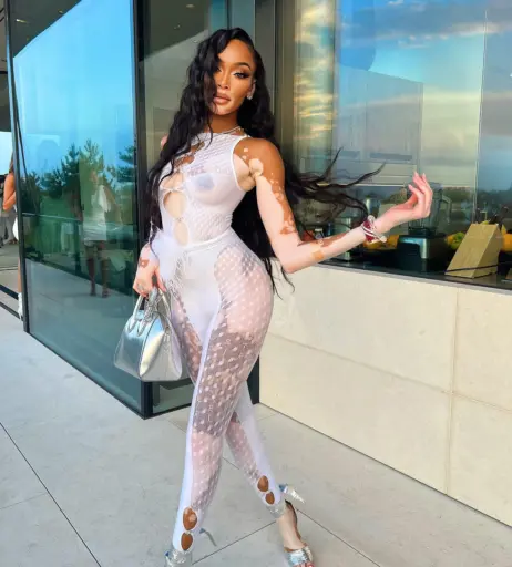 Image 1731452 from Winnie Harlow
