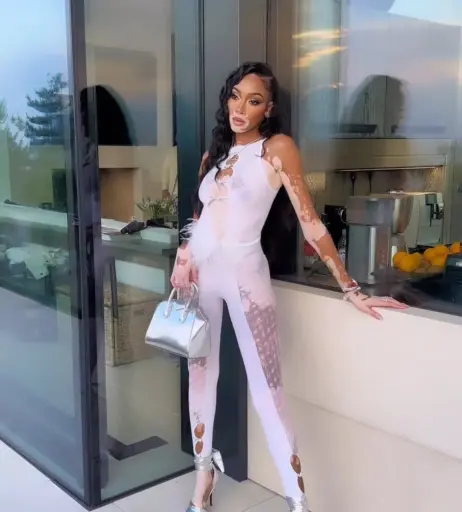 Image 1731799 from Winnie Harlow