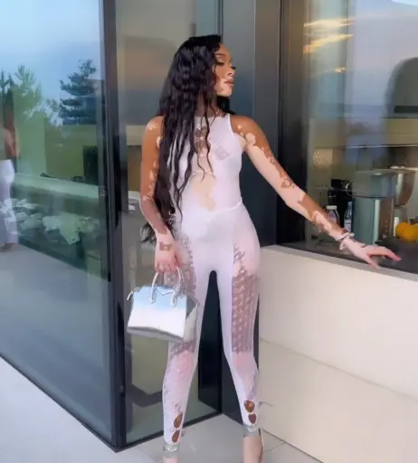 Image 1731764 from Winnie Harlow