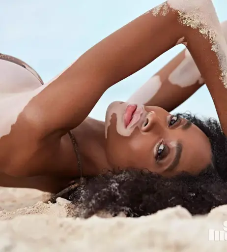 Image 1731156 from Winnie Harlow