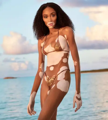 Image 1731129 from Winnie Harlow