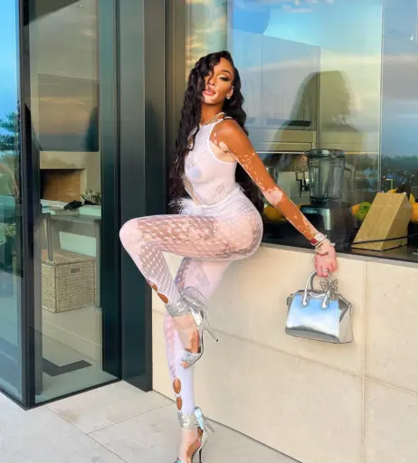 Image 1731357 from Winnie Harlow