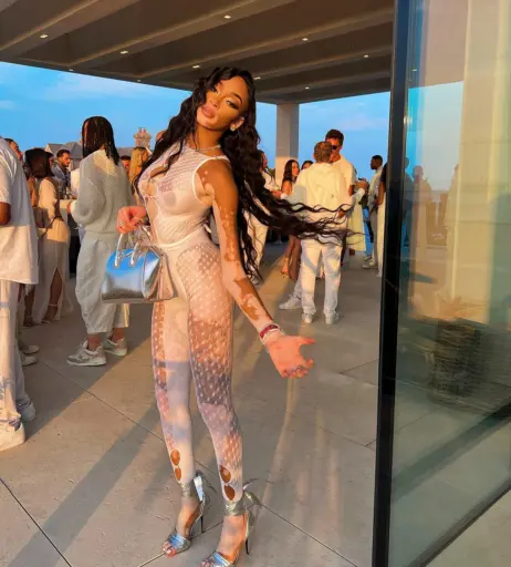 Image 1731378 from Winnie Harlow