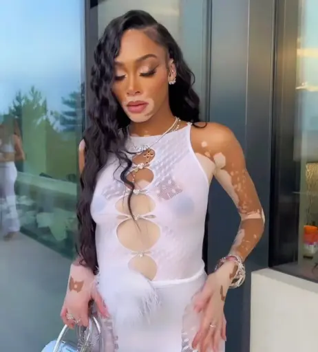 Image 1731306 from Winnie Harlow