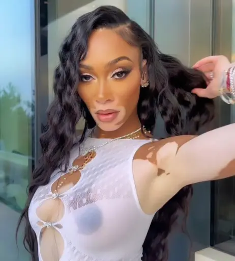 Image 1731332 from Winnie Harlow