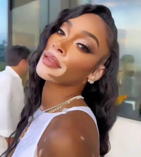Image 1731963 from Winnie Harlow