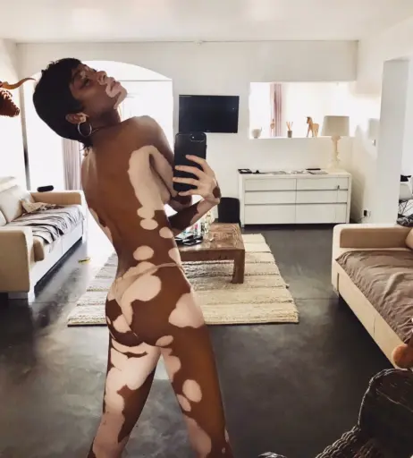 Image 1732850 from Winnie Harlow