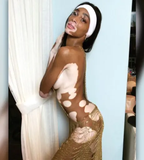 Image 1732804 from Winnie Harlow