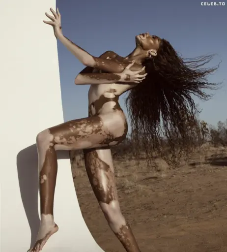 Image 1732485 from Winnie Harlow