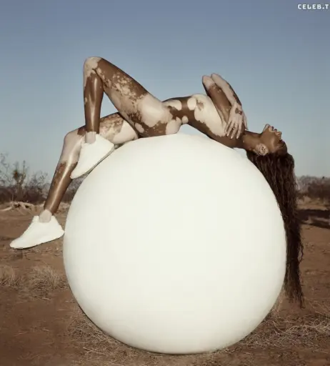 Image 1732461 from Winnie Harlow