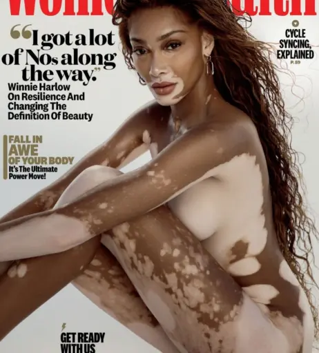 Image 1732041 from Winnie Harlow