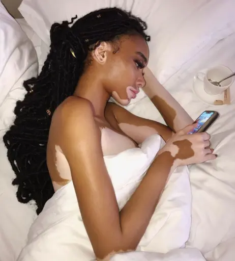 Image 1732015 from Winnie Harlow