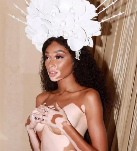 Image 1732905 from Winnie Harlow