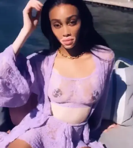 Image 1733850 from Winnie Harlow