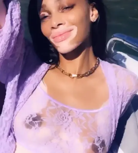 Image 1733801 from Winnie Harlow