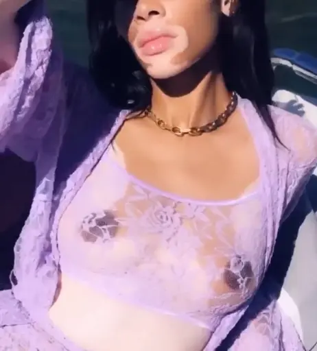 Image 1733781 from Winnie Harlow