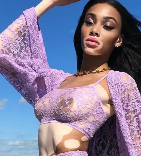 Image 1733709 from Winnie Harlow