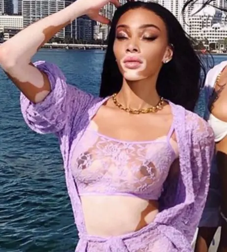 Image 1733734 from Winnie Harlow