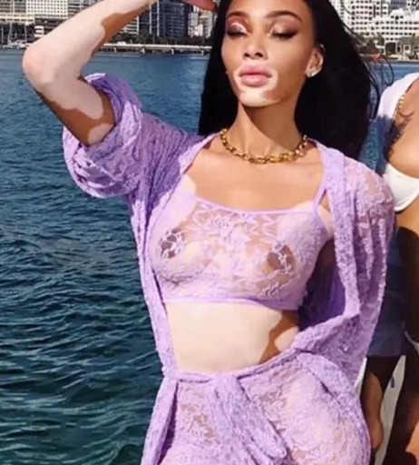 Image 1733655 from Winnie Harlow