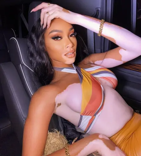 Image 1733005 from Winnie Harlow
