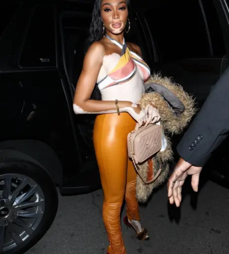Image 1733022 from Winnie Harlow