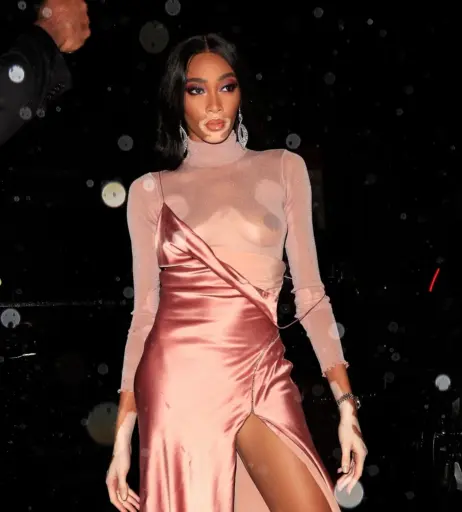 Image 1733338 from Winnie Harlow