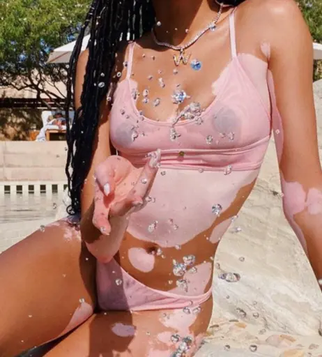 Image 1733948 from Winnie Harlow