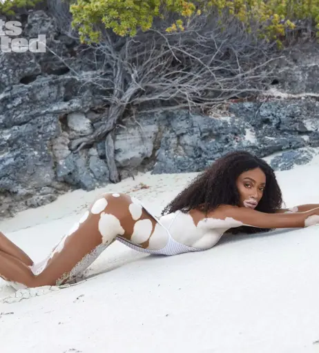 Image 1730536 from Winnie Harlow
