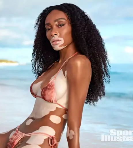 Image 1730037 from Winnie Harlow