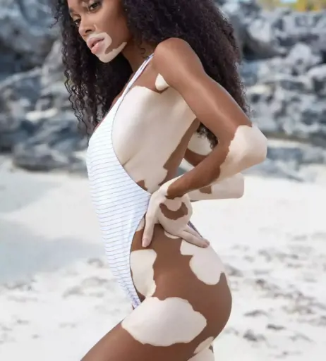 Image 1730260 from Winnie Harlow
