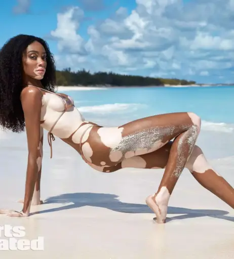 Image 1730225 from Winnie Harlow