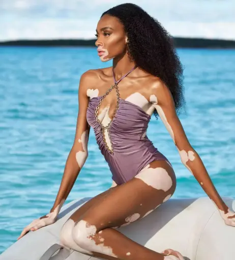 Image 1730983 from Winnie Harlow
